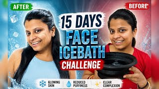 I Tried Ice Bath on My Face for 15 Days🧊Before & After Transformation | Results You Need to See!