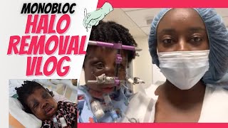 CALI GETS HER HALO REMOVED | SURGERY DAY | PFEIFFER SYNDROME