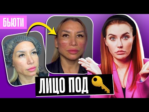 Видео: УРОДУЮТ ЛИЦО! | КУРС КОСМЕТОЛОГА ЗА 5 ДНЕЙ