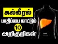     10 early signs of liver damage tamil  symptoms of liver problems