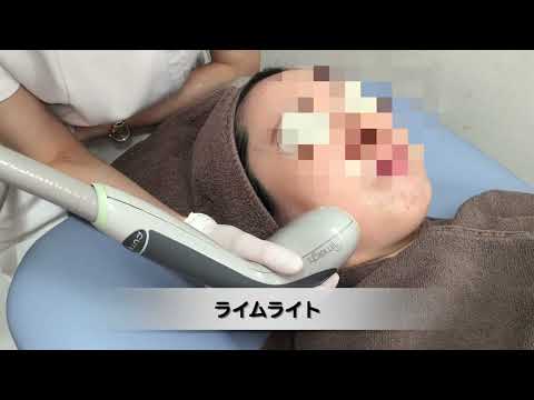 ライムライト