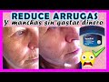 VASELINA para QUITAR ARRUGAS  😱 🔴 Quita MANCHAS en 20 minutos ✅ - YOLIANA GAMBOA