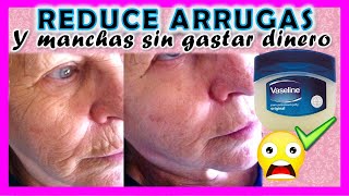 VASELINA para QUITAR ARRUGAS  😱 🔴 Quita MANCHAS en 20 minutos ✅ - YOLIANA GAMBOA screenshot 4