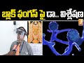 Dr Prabhakar Reddy on increasing black fungus cases