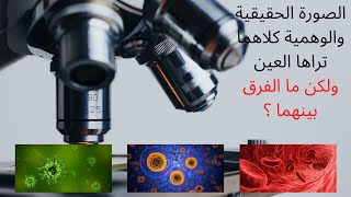 كيف يمكّننا الميكروسكوب من رؤية الاجسام بالغة الصغر ؟