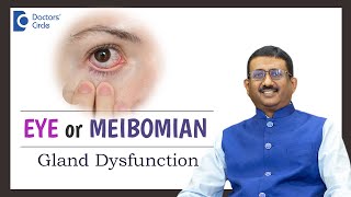 Emerging Treatment for Dry Eye from Meibomian Gland Dysfunction-Dr.Sriram Ramalingam|Doctors' Circle