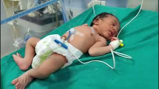 Nicu cute baby #newbornbaby #viralvideo #cutebaby 