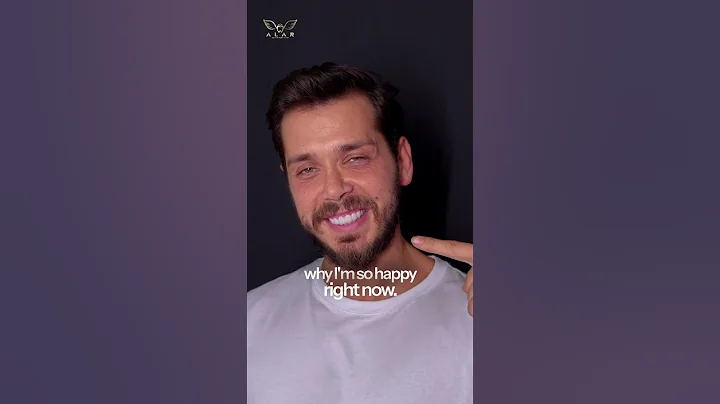 Laminate Veneers  Stunning Before & After Smile Transformations #dentist  #smiledesigndental