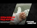 &quot;Зубы вошли под ноготь&quot; - бездомная собака покусала девочку