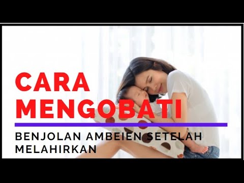 Cara Mengobati Benjolan Ambeien Setelah Melahirkan