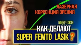 🔴 Супер Фемто Ласик как проходит операция? Лазерная коррекции зрения в Москве.