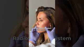 Hautstraffung Frankfurt | HIFU Behandlung + RF | VOLFORMER Lift ohne OP ✨