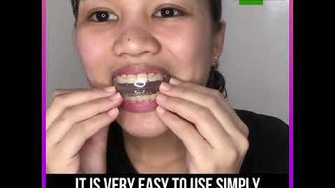 Why Use Invisible Braces?