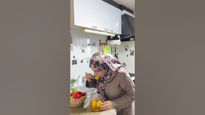 هو وحم المرأه الحامل ممكن فعلا يكون بالشكل ده ؟!😅