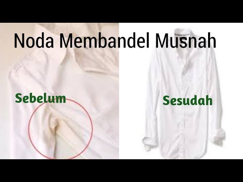  Cara  Menghilangkan  Noda  Kuning  di  Baju  putih dan berwarna  