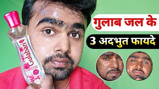 Gulab Jal Ke Fayde | Rose Water Benefits For Face| Gulab Jal Lagane Se Kya Hota Hai screenshot 2