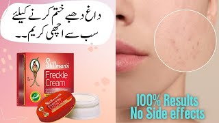 Stillman's Freckle Cream Honest Review, Beanfits, Uses, Price | World No 1 Acne Removal Beauty Cream