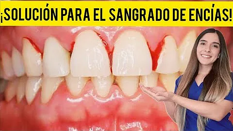 ¿Puede provocar sangre un cepillado demasiado fuerte?