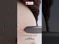 From Follicle to Full Hairline | Hair Transplant Process ASG Hair Transplant |Real &amp; Natural Results