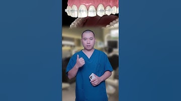 Niềng răng hay bọc răng sứ tốt hơn? I Nha Khoa Smile HT #niengrang #bocrangsu #smileht #nhakhoa