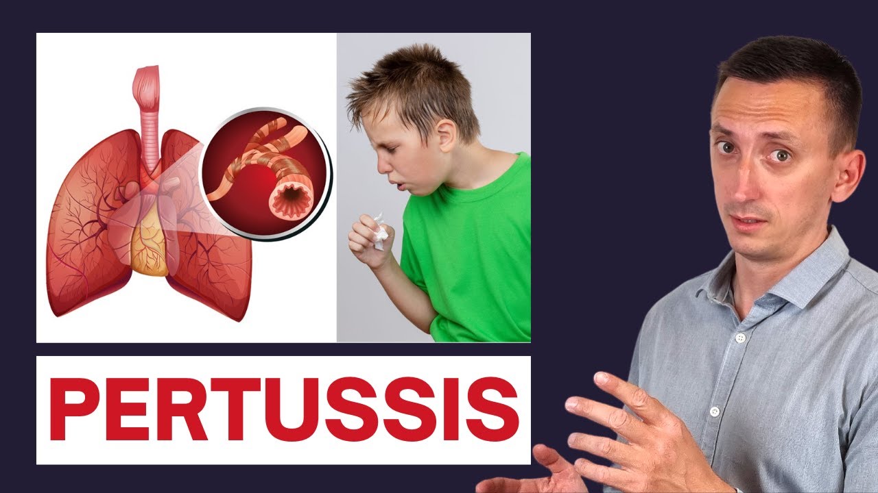 Whooping Cough (Pertussis): All You Need to Know