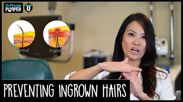 Are some people more prone to ingrowns? (2023)