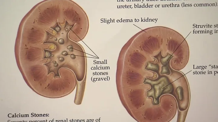 What to do if you spot blood in your urine