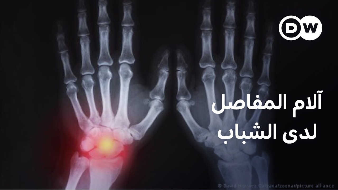 ����� ����� ���� ������� ��� �����ȿ | ���� ��� ����
 - نشر قبل 2 ساعة