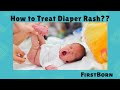 How to Treat Diaper Rash |  | Baby Rash| Babies|डायपर रेेश कैसे मिटाएं|First Born