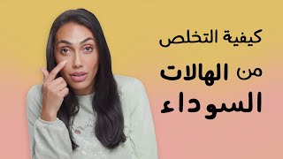 4 خلطات وحيل تعالج الهالات السوداء تحت عيونك ... جربيها ولاحظي الفرق! | مع سارة صوفي