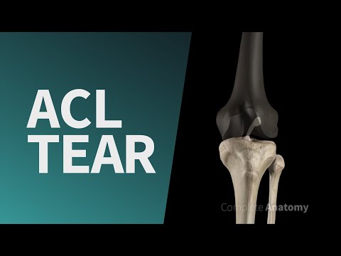 Vídeo: On és una llàgrima acl?