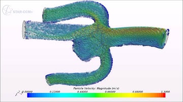 CFD-model of red blood cells in a brain aneurysm