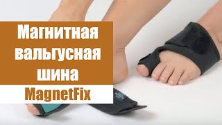 Выросла косточка на ноге ⭐ Valufix вальгусная шина отзывы 👌