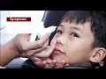 Mayo Clinic Minute What Parents Need To Know About Pink Eye 