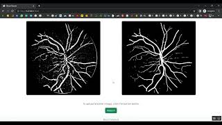 Retinal Vessel Image Analysis Jupyter Flask App in Python Projects