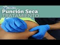 ¿Qué es la PUNCIÓN SECA? TRATAMIENTO para PUNTOS GATILLO | Fisiolution