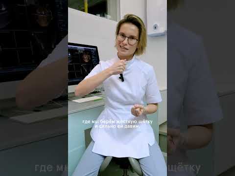 Десна оголила корень