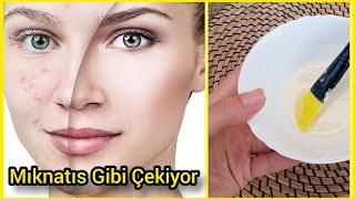 Cildi Yay Gibi Geriyor - Tek Malzeme İle 10 Yaş Gençleş - (%100 ETKİLİ) #doğalbotoks