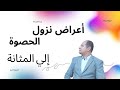 أعراض نزول الحصوة إلى المثانة 