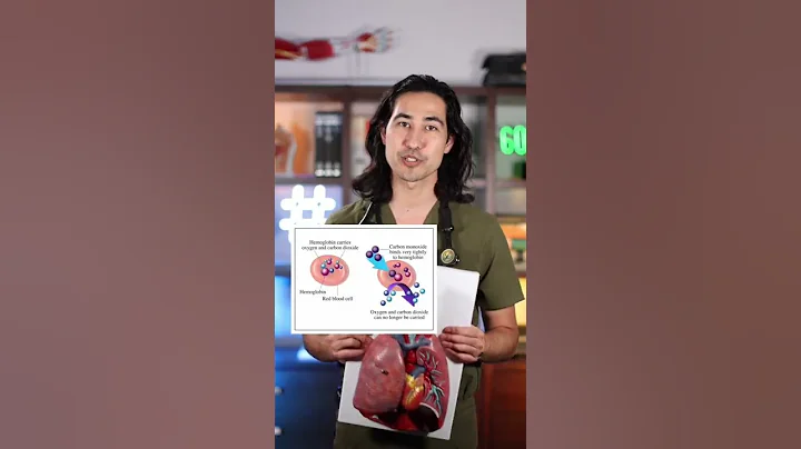 Carbon Monoxide Poisoning: Doctor Explains