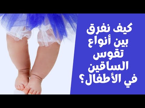 فيديو: هل يمكن تصحيح تقوس الساق عند الأطفال؟