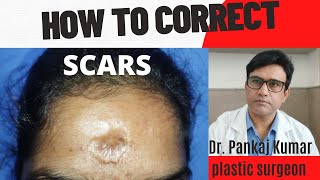 Scar Treatment| Scar surgery at Ranchi| Cosmetic Surgery Ranchi.