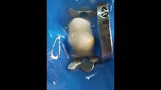 Access Cavity Preparation of Maxillary First Premolar