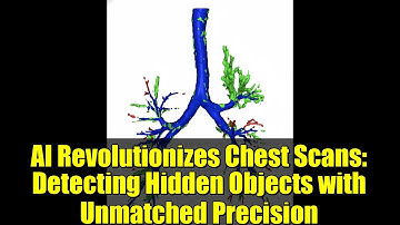 AI Revolutionizes Chest Scans: Detecting Hidden Objects with Unmatched Precision