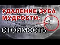 Сколько стоит удалить зуб мудрости? / Удаление зуба мудрости / СЛОЖНОСТИ удаления зуба мудрости