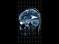ADHD Science History and Treatment Future