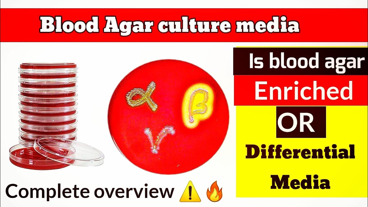 Blood Agar hemolysis, preparation, Composition and difference between