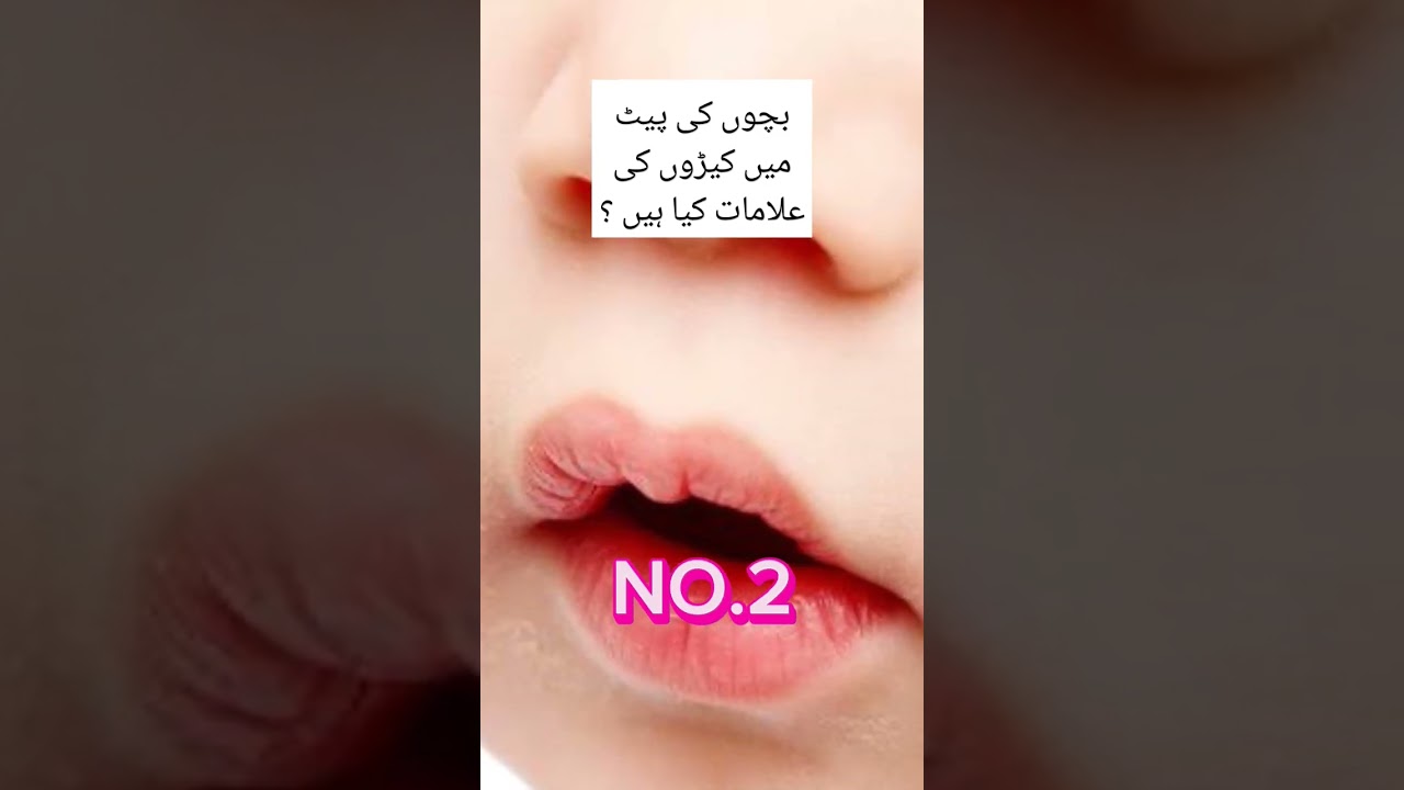 What are the symptoms of stomach worms in children? / 