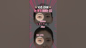 💆🏻‍♀️10초 만에 눈 붓기 빼는 법💆🏻‍♀️