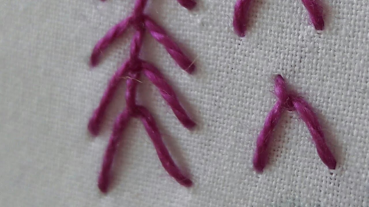 Y iğnesi tekniği nasıl yapılır?